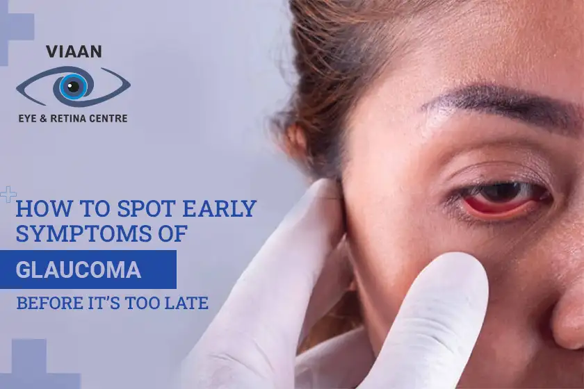 How to Spot Early Symptoms of Glaucoma Before It’s Too Late