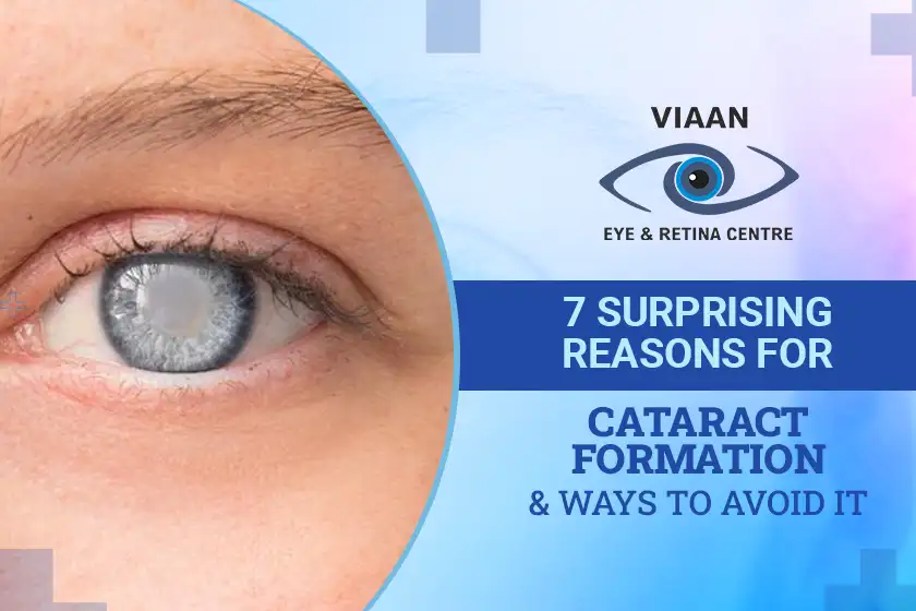 7 Surprising Reasons for Cataract Formation and Ways to Avoid It