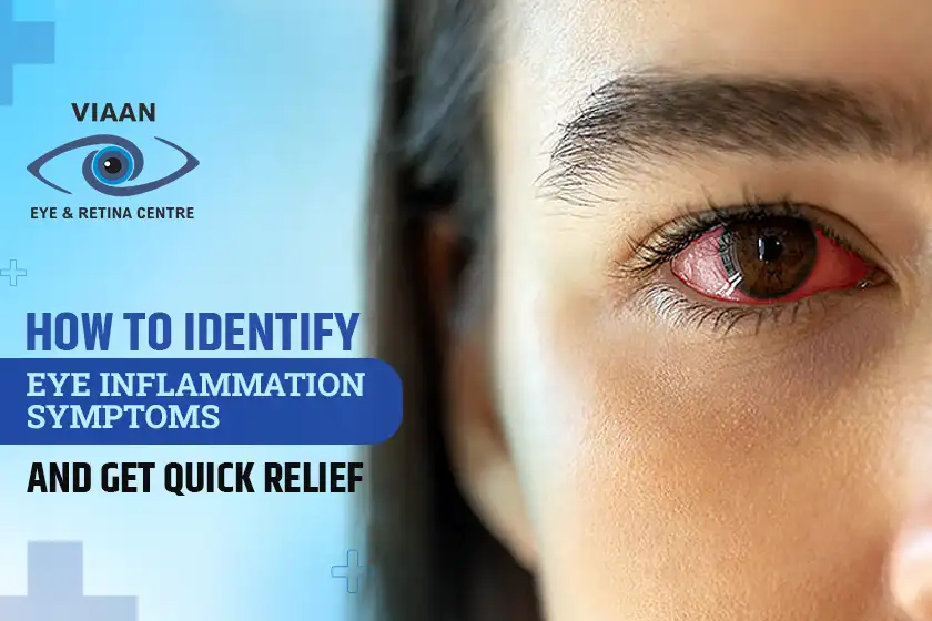 eye inflammation symptoms
