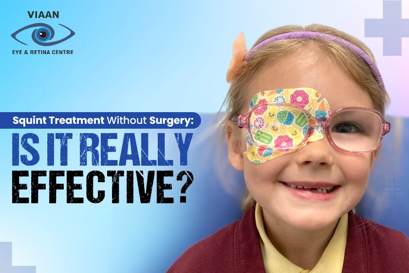 Squint treatment without surgery