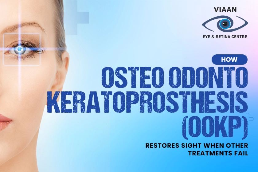 osteo odonto keratoprosthesis (OOKP)
