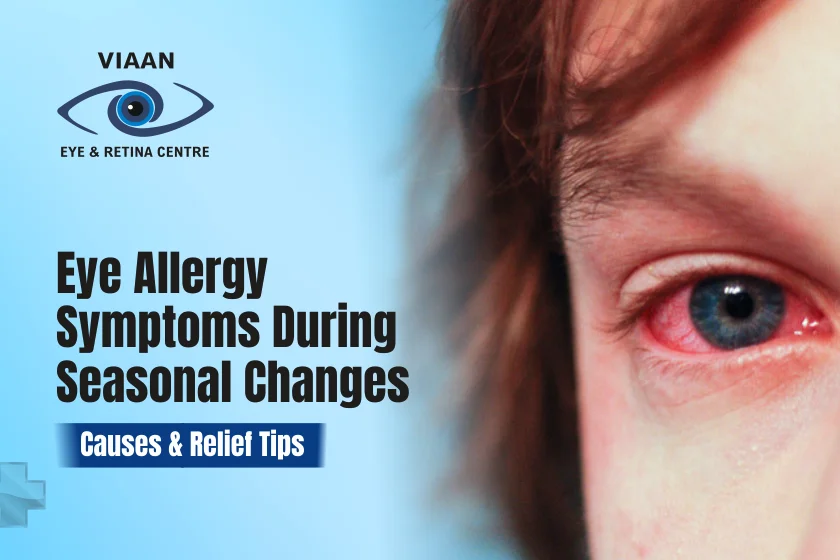 Eye Allergy Symptoms