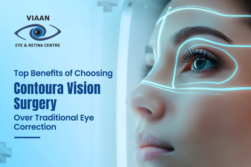 Top Benefits of Choosing Contoura Vision Surgery Over Traditional Eye Correction