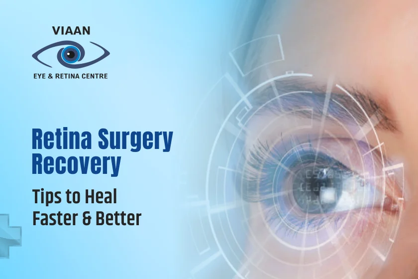 Retina Surgery Recovery Tips to Heal Faster and Better