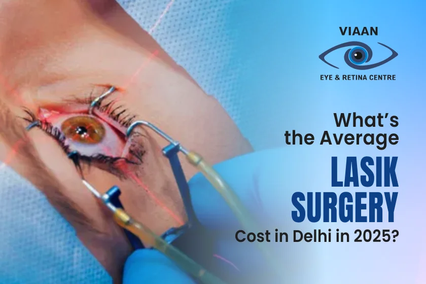 What’s the Average LASIK Surgery Cost in Delhi in 2025?