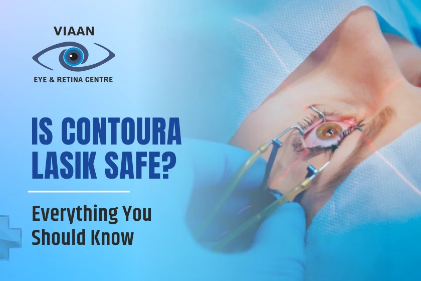 Is Contoura LASIK Safe? Everything You Should Know