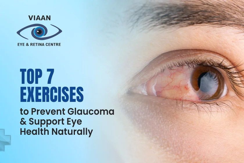 Top 7 Exercises to Prevent Glaucoma and Support Eye Health Naturally